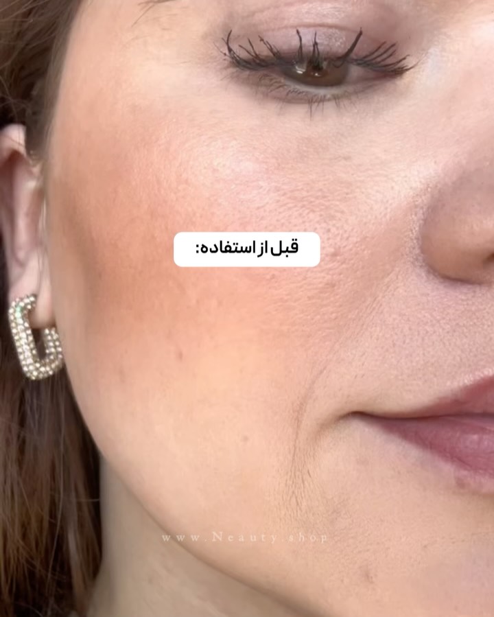 تصویر پست از @neauty.shop — 5/7